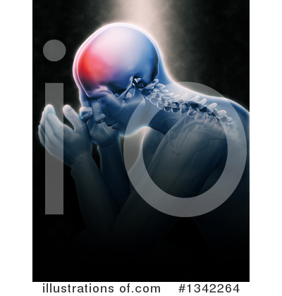 Migraine Clipart #1342264 by KJ Pargeter