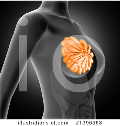 Breast Cancer Clipart #1396363 by KJ Pargeter