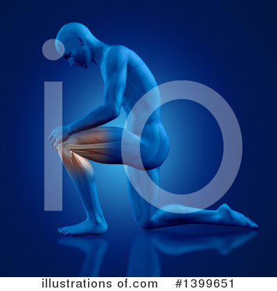 Knee Pain Clipart #1399651 by KJ Pargeter