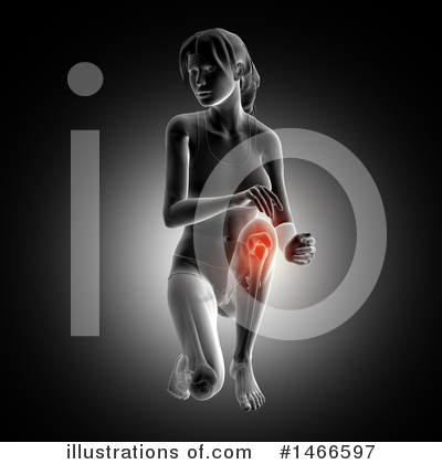 Knee Pain Clipart #1466597 by KJ Pargeter