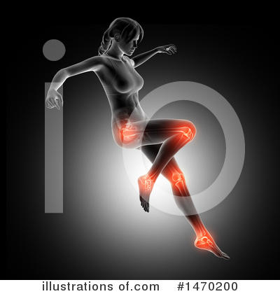 Knee Pain Clipart #1470200 by KJ Pargeter