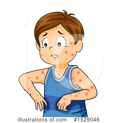 Measles Clipart #1529046 by BNP Design Studio