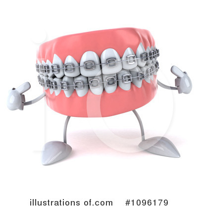 Orthodontics Clipart #1096179 by Julos