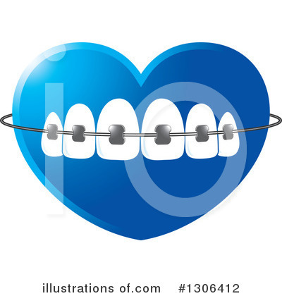 Royalty-Free (RF) Braces Clipart Illustration by Lal Perera - Stock Sample #1306412