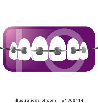 Royalty-Free (RF) Braces Clipart Illustration by Lal Perera - Stock Sample #1306414