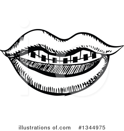 Royalty-Free (RF) Braces Clipart Illustration by Vector Tradition SM - Stock Sample #1344975