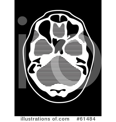 Royalty-Free (RF) Brain Clipart Illustration by r formidable - Stock Sample #61484