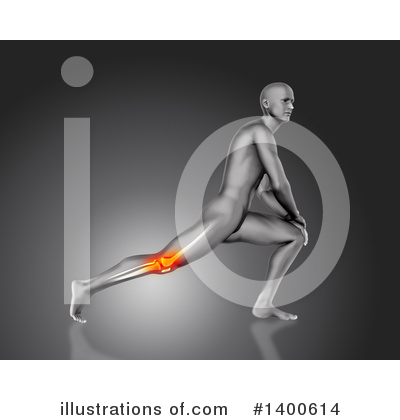 Knee Pain Clipart #1400614 by KJ Pargeter