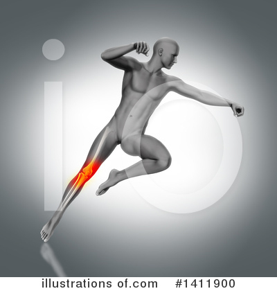 Knee Pain Clipart #1411900 by KJ Pargeter