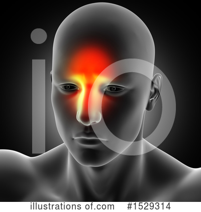 Headache Clipart #1529314 by KJ Pargeter