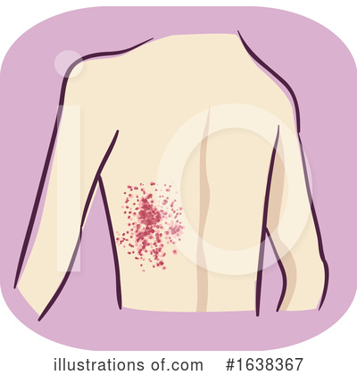Royalty-Free (RF) Medical Clipart Illustration by BNP Design Studio - Stock Sample #1638367