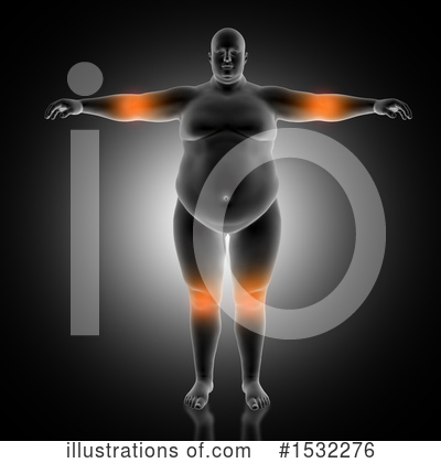 Obesity Clipart #1532276 by KJ Pargeter