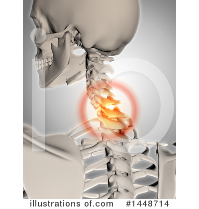 Royalty-Free (RF) Pain Clipart Illustration by KJ Pargeter - Stock Sample #1448714