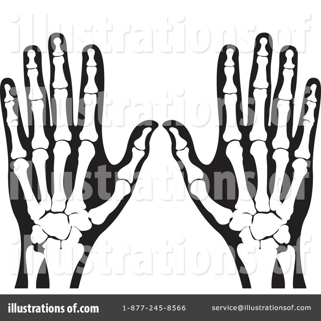 hand x ray clipart - photo #11