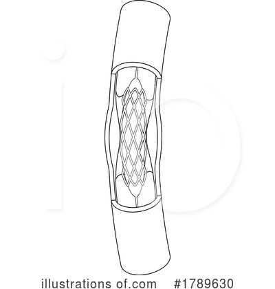 Royalty-Free (RF) Stent Clipart Illustration by Lal Perera - Stock Sample #1789630