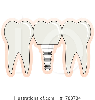 Tooth Clipart #1788734 by Lal Perera
