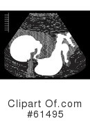 Ultrasound Clipart #61495 by r formidable