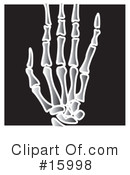 Xray Clipart #15998 by Andy Nortnik