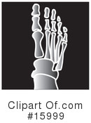 Xray Clipart #15999 by Andy Nortnik