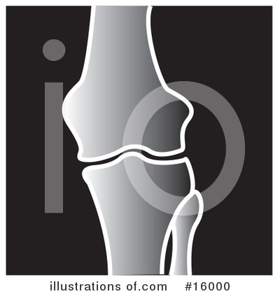 Royalty-Free (RF) Xray Clipart Illustration by Andy Nortnik - Stock Sample #16000