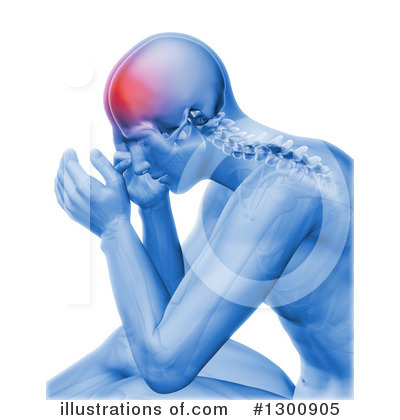 Headache Clipart #1300905 by KJ Pargeter