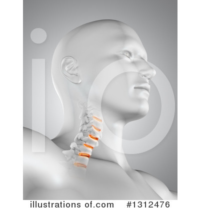 Neck Pain Clipart #1312476 by KJ Pargeter