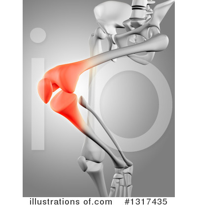 Knee Pain Clipart #1317435 by KJ Pargeter