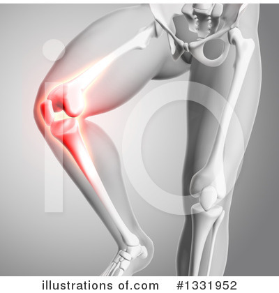 Knee Pain Clipart #1331952 by KJ Pargeter