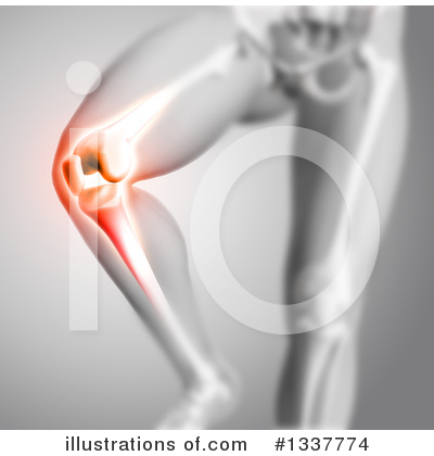 Knee Pain Clipart #1337774 by KJ Pargeter