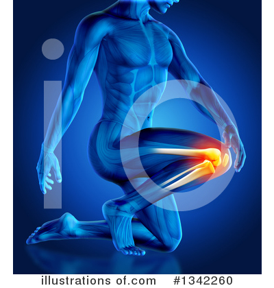 Knee Pain Clipart #1342260 by KJ Pargeter