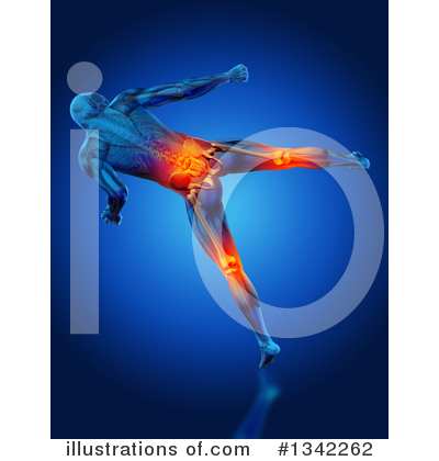 Knee Pain Clipart #1342262 by KJ Pargeter