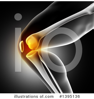 Knee Pain Clipart #1395136 by KJ Pargeter