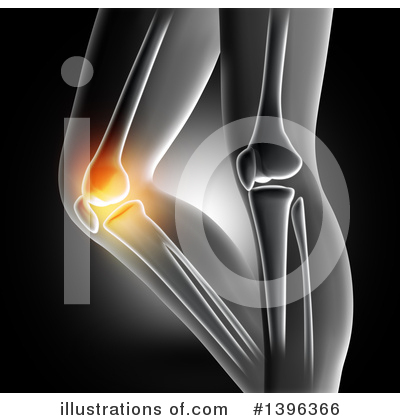 Knee Pain Clipart #1396366 by KJ Pargeter