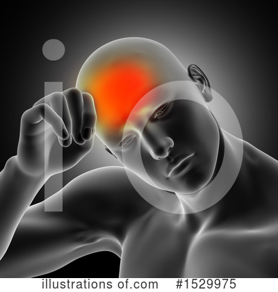 Royalty-Free (RF) Headache Clipart Illustration by KJ Pargeter - Stock Sample #1529975