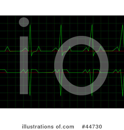 Royalty-Free (RF) Heart Monitor Clipart Illustration by oboy - Stock Sample #44730