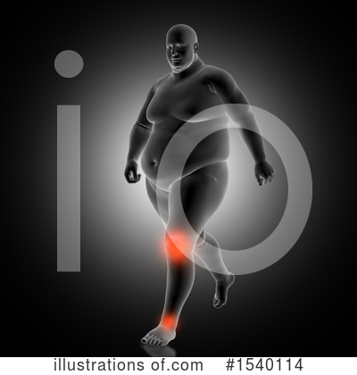 Knee Pain Clipart #1540114 by KJ Pargeter