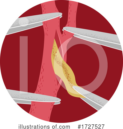 Royalty-Free (RF) Medical Clipart Illustration by BNP Design Studio - Stock Sample #1727527