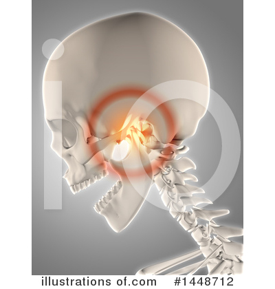 Royalty-Free (RF) Pain Clipart Illustration by KJ Pargeter - Stock Sample #1448712