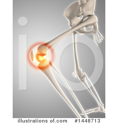 Royalty-Free (RF) Pain Clipart Illustration by KJ Pargeter - Stock Sample #1448713