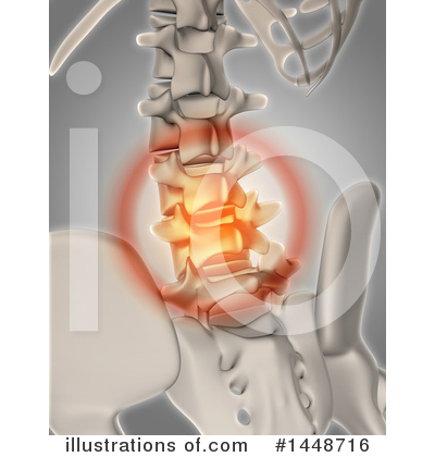 Royalty-Free (RF) Pain Clipart Illustration by KJ Pargeter - Stock Sample #1448716