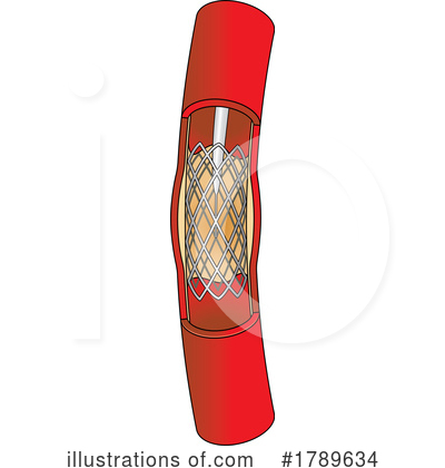 Royalty-Free (RF) Stent Clipart Illustration by Lal Perera - Stock Sample #1789634