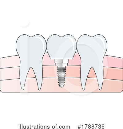Royalty-Free (RF) Teeth Clipart Illustration by Lal Perera - Stock Sample #1788736
